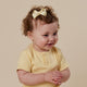 Lemon Bow Hair Clip - Thumbnail 1